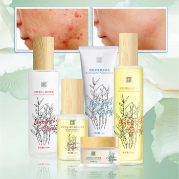 Rungenyuan Purifying cleanser hydrating toner acne reparação de pequeno frasco de acne soro de cuidados com a pele da água de creme de acne cuidados da pele